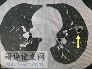 医学论文摘要