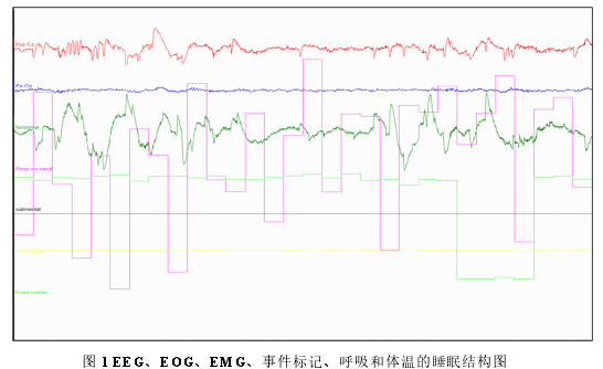 图 1 EEG、EOG、EMG、事件标记、呼吸和体温的睡眠结构图