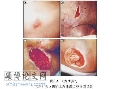 护理论文怎么写
