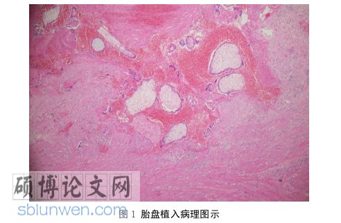 临床医学论文参考