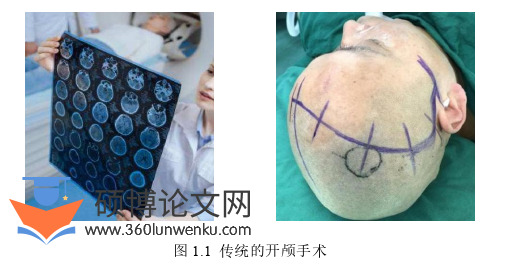 机械论文怎么写
