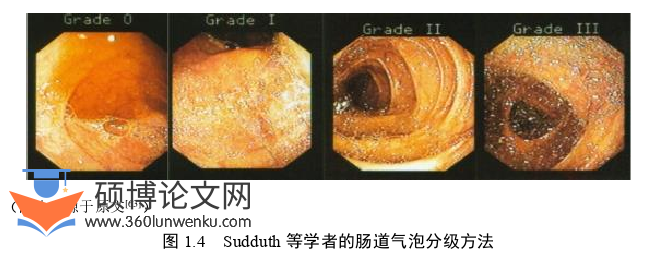 护理论文参考