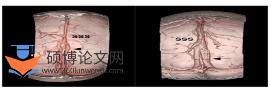 医学论文怎么写