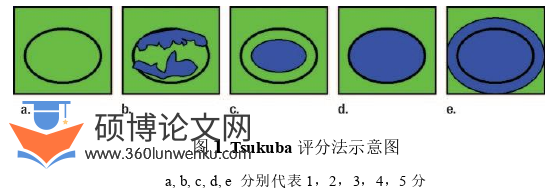 医学论文怎么写